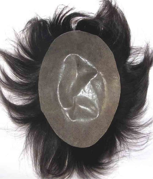 Poly Lace Hair Patch in Hyderabad